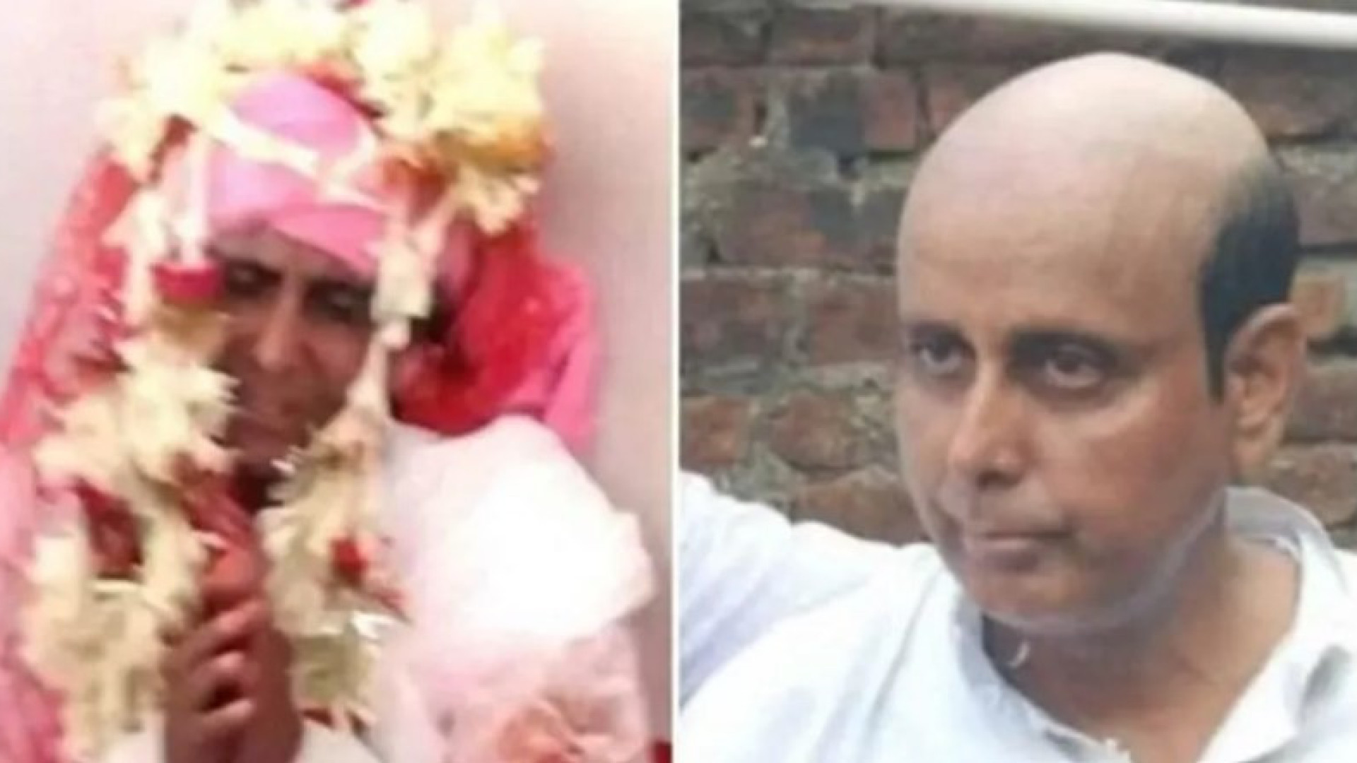 Após revelar que é careca, noivo é agredido durante casamento na Índia