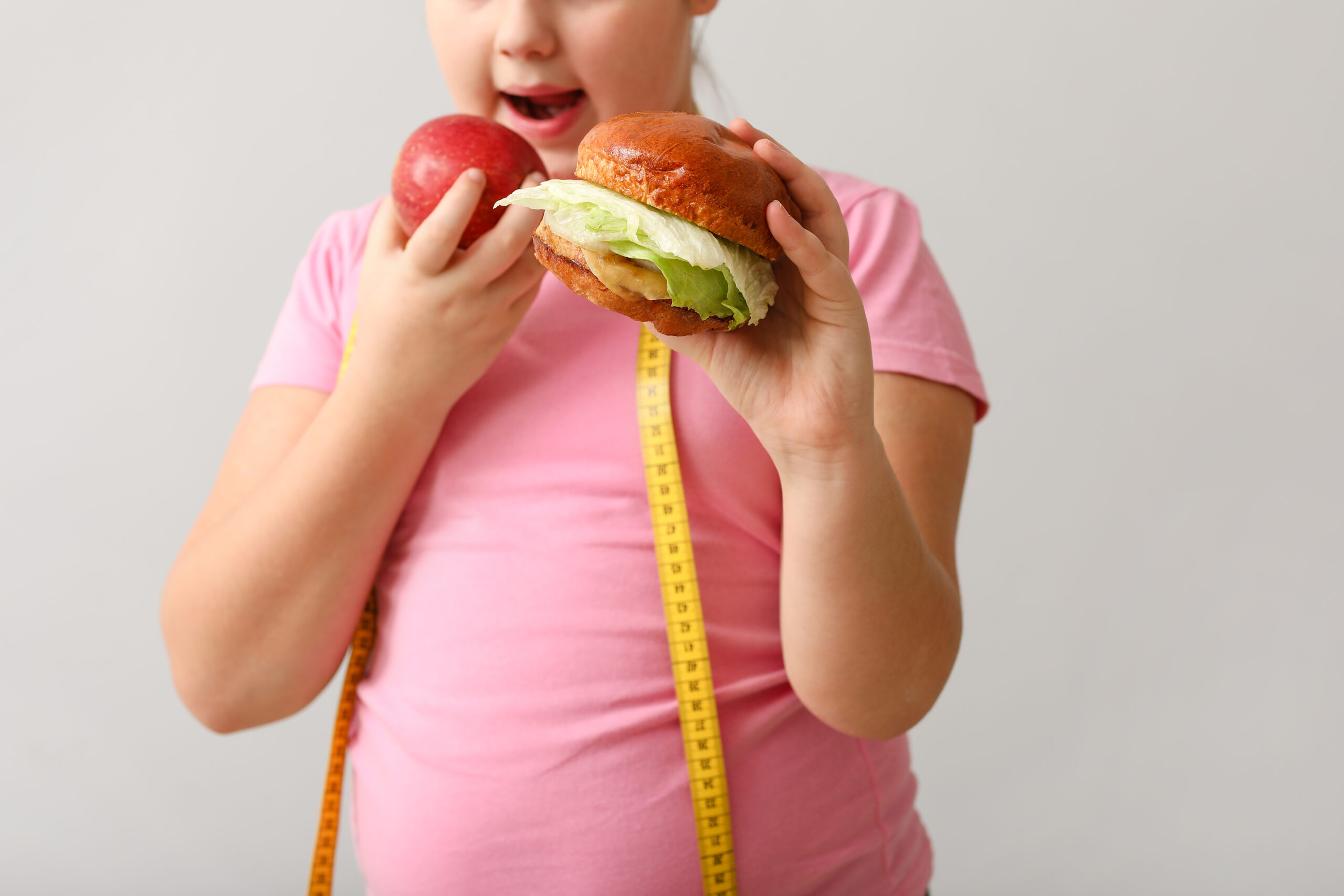 Obesidade em jovens aumenta 90% em um ano devido a estilo de vida com sedentarismo e má alimentação