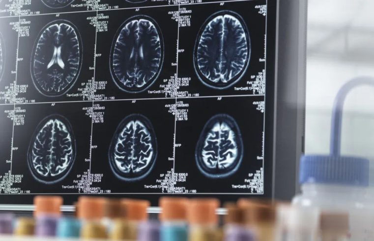 Poluição do ar pode estar relacionada a sinais de Alzheimer