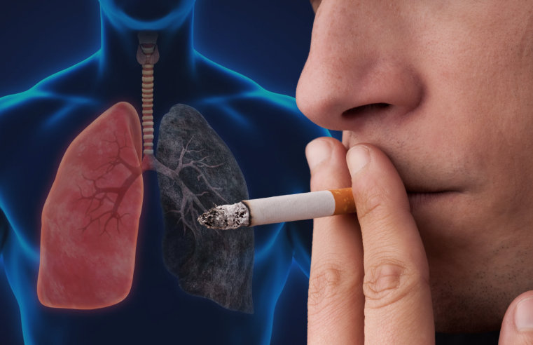 Estudo revela que tabagismo é responsável por 80% das mortes por câncer de pulmão no Brasil