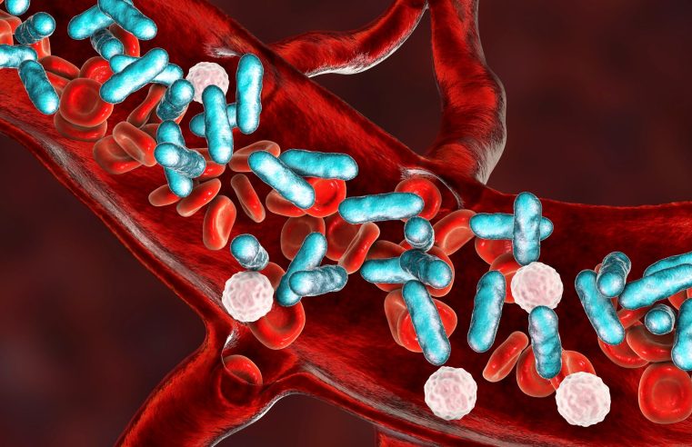 Choque séptico: infecção de origem da sepse pode ser bacteriana, fúngica, viral, parasitária ou por protozoários