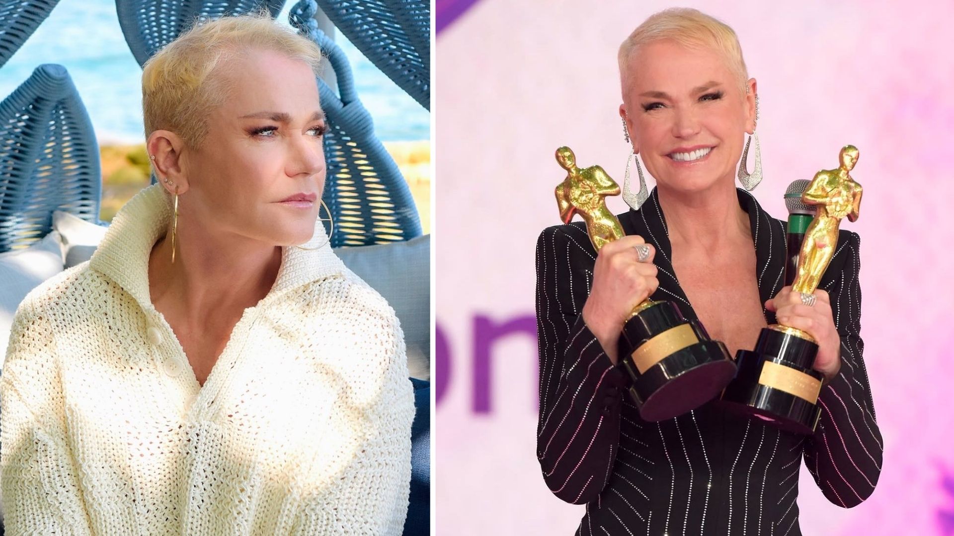 Xuxa é internada para cirurgia no joelho em hospital de SP