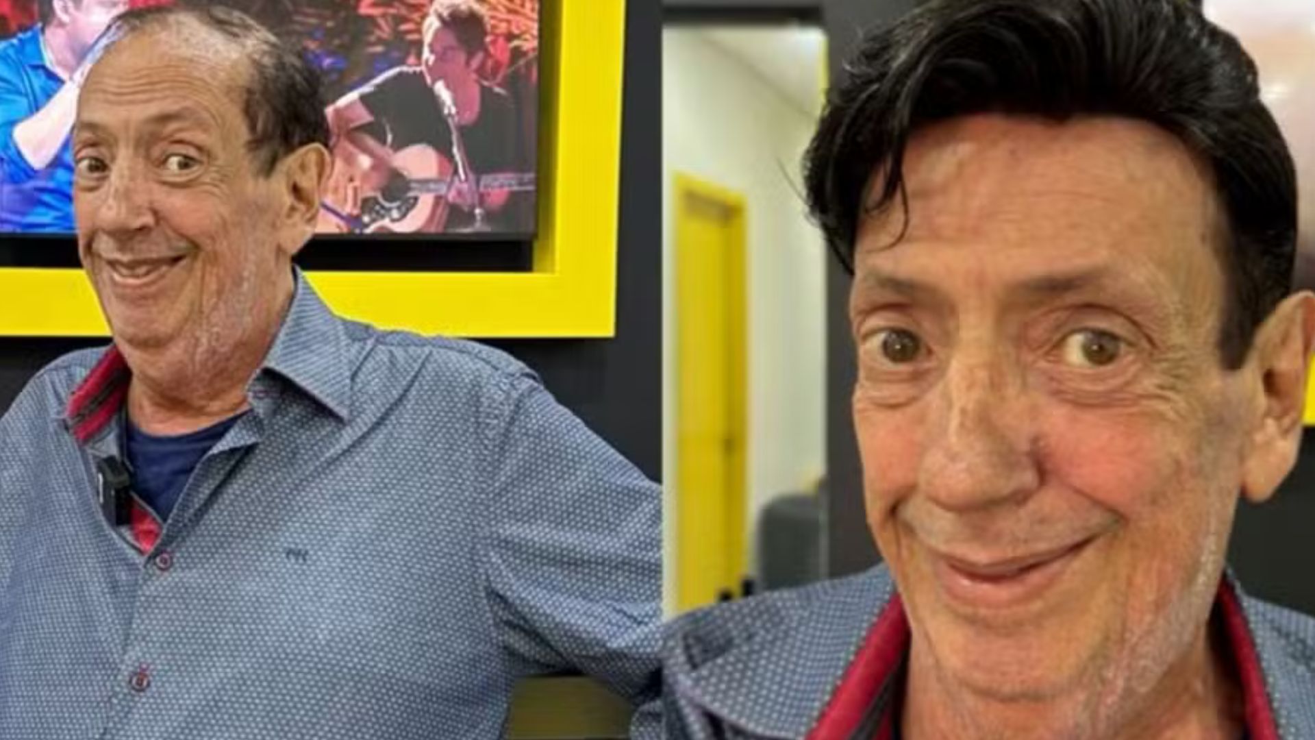 Marcos Oliveira adota prótese capilar e celebra novo visual: ‘Um velho de chanel não combina, né?’